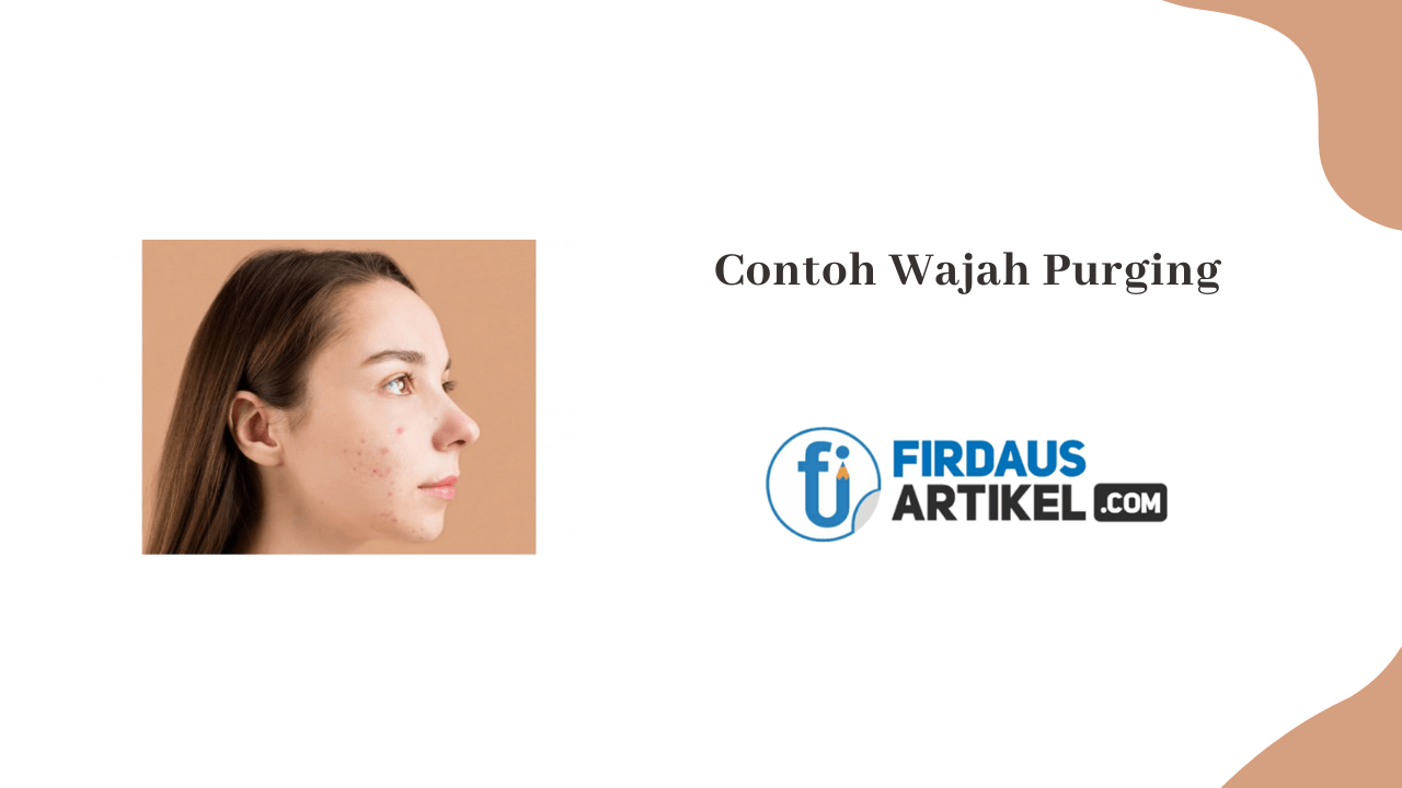 contoh wajah purging
